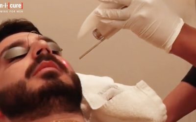 Laser Hair Removal for Men in Toronto: What to Expect