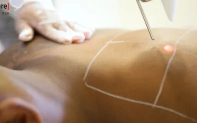 Laser or Wax? Manscaping Services That Work